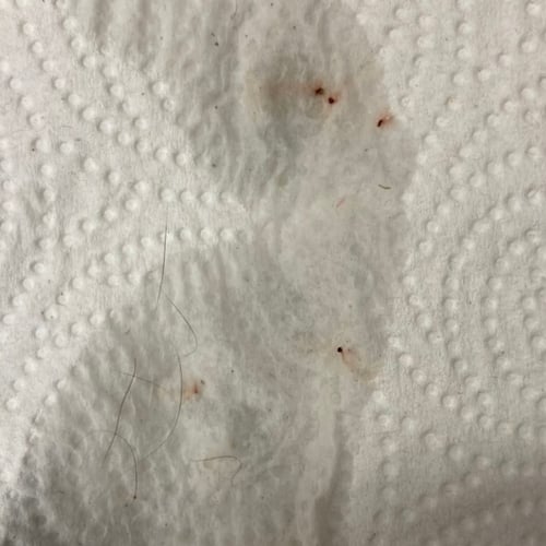 flea dirt on wet paper towel